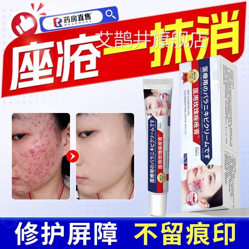 玫瑰痤疮糠疹膏屏障修复痘痘专消祛炎痘用抗炎修痘印护复肤品精华