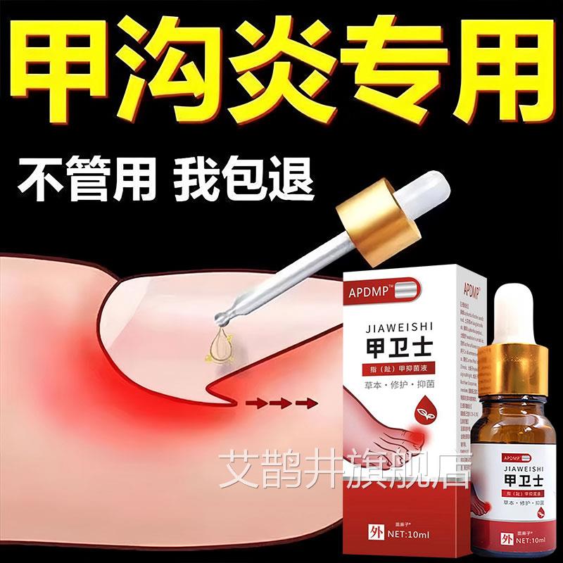 甲卫士甲沟炎药息肉去除液专脚指往肉里长特器治效疗嵌甲软化甲剂