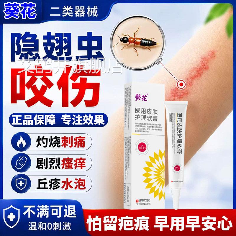 葵花隐翅虫红蚂蚁叮烧咬伤预防留疤痕过敏痒肿灼感特专用效膏L艾
