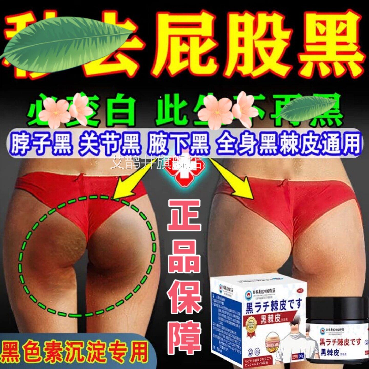本脖子大腿内日侧黑色素沉淀去除屁股祛坐印臀部发黑坐茧黑棘皮膏