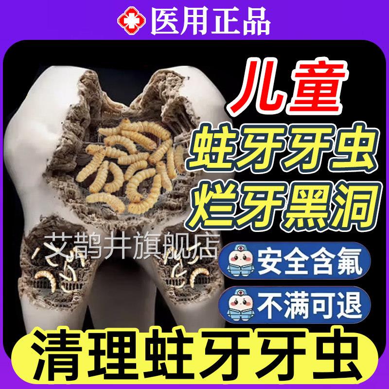 小葵花医用儿童蛀牙龋齿修牙覆专用膏虫牙牙洞清理牙虫的药防蛀TT