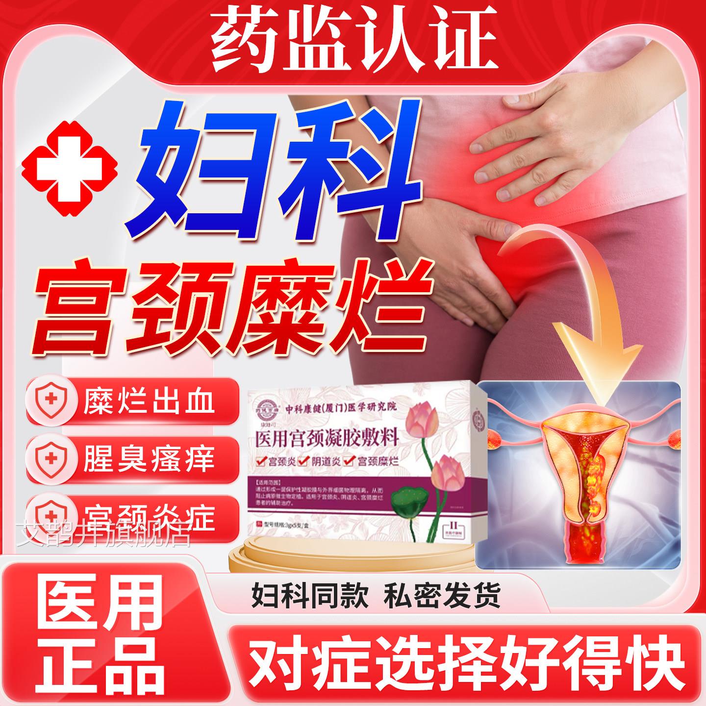 宫颈重度糜烂专用药妇科阴中道塞凝胶宫颈炎消糜栓二度三度用药u9