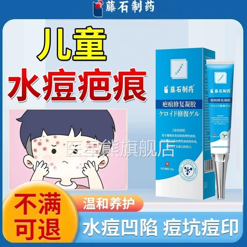 水痘疤痕修去水痘坑痘印凹洞生长因子陷祛疤膏儿专用小孩S童K医星