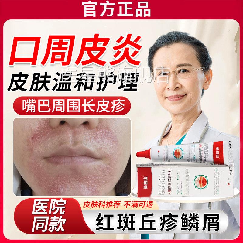 口周皮炎嘴巴周围红斑丘疹瘙痒过敏起皮专用唇皮周炎干燥起脱屑UU