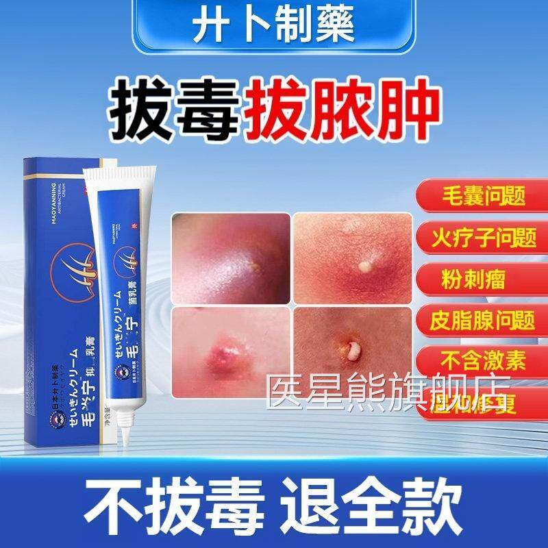 疖肿拔膏断痒拔毒膏火疖子的囊肿痛脓包皮脂腺痛毒私处外阴囊毛囊