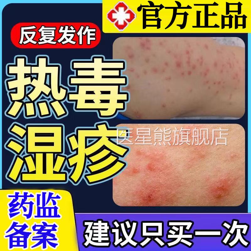 热毒湿疹一止痒膏皮肤热就痒瘙痒专用除红斑皮炎湿疹红肿感染喷rr