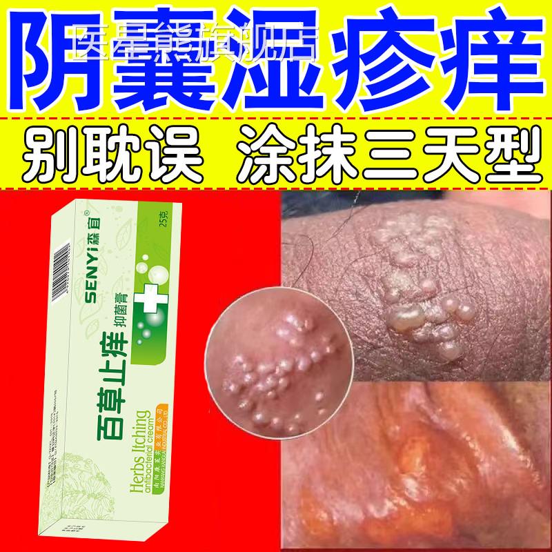 阴囊瘙痒湿疹止痒私处睾潮丸痒男人下面湿蛋蛋痒真菌特皮肤效药膏