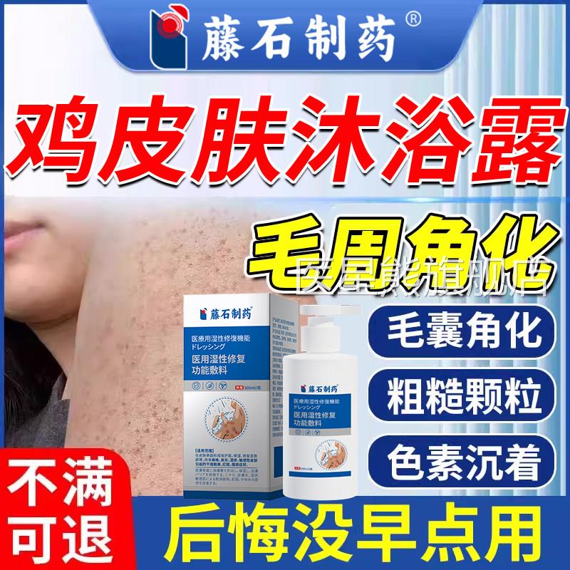 手臂鸡皮肤疙香皂毛囊角化症专外瘩用药房同售沐浴露腿身体乳CA医