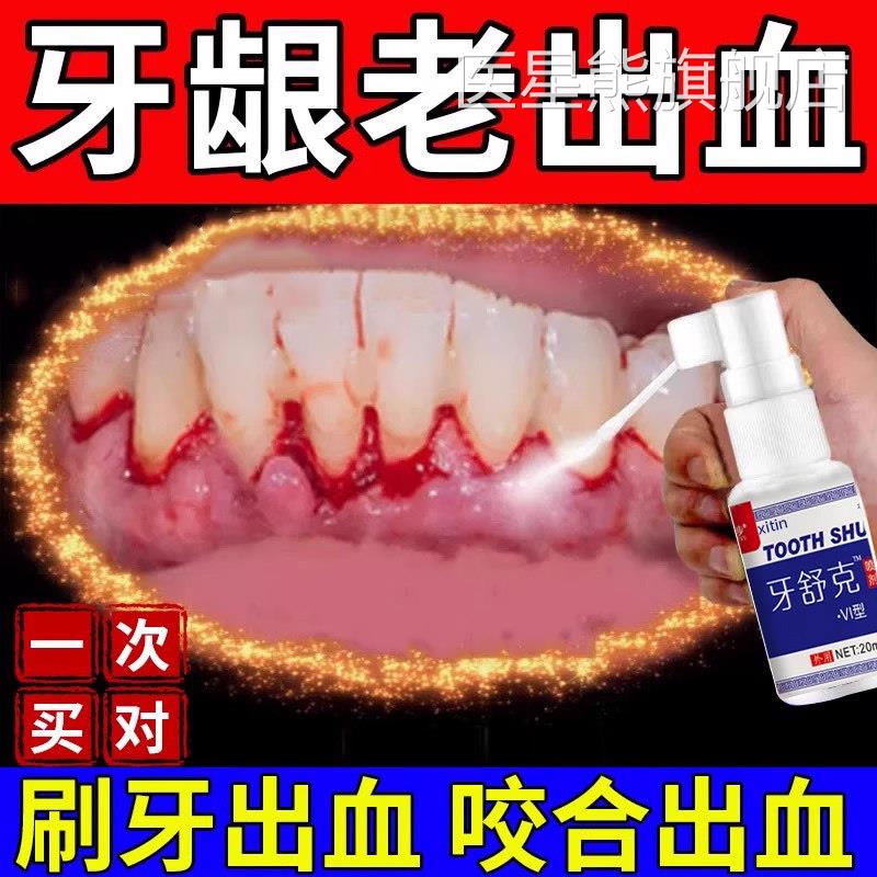 云南白药牙膏牙周炎牙龈出血专用牙喷剂牙龈脓包肿痛消炎脱敏膏UU