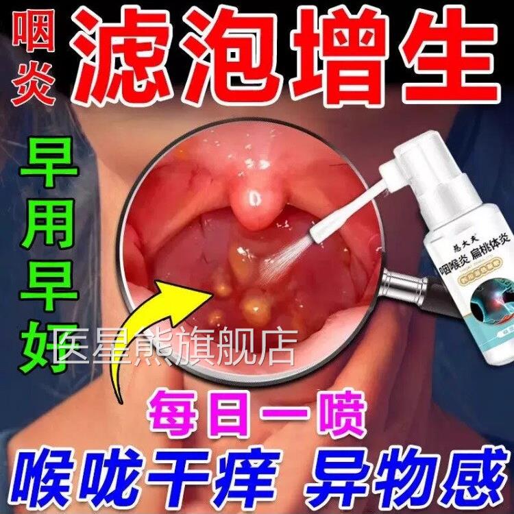 治疗喉咙滤泡增生后壁淋巴慢咽炎咽喉炎根专慢性性咽炎除用喷剂LL