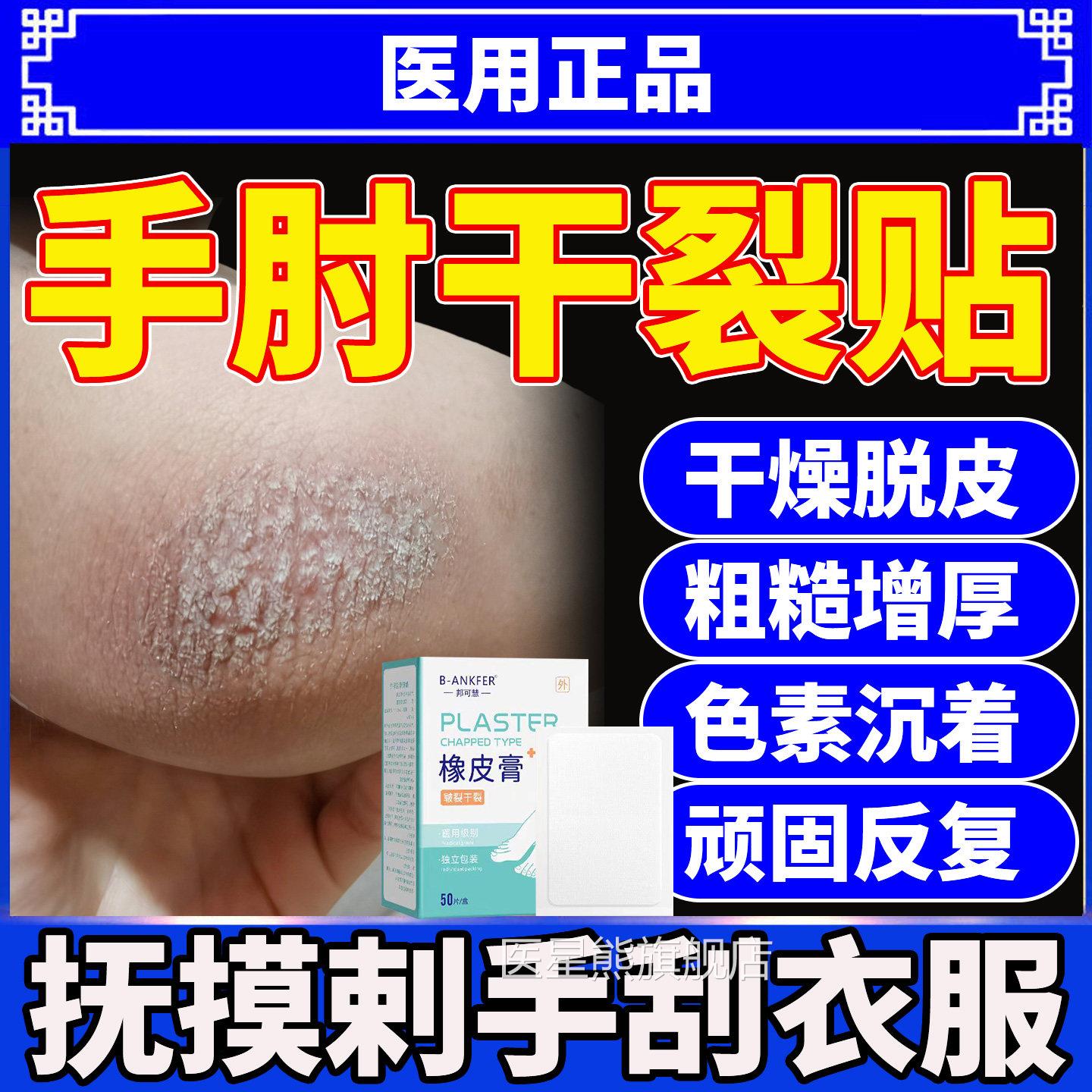 胳膊肘干裂手肘干燥起皮保套湿防磨损开裂去黑去死皮去角质膏贴CA