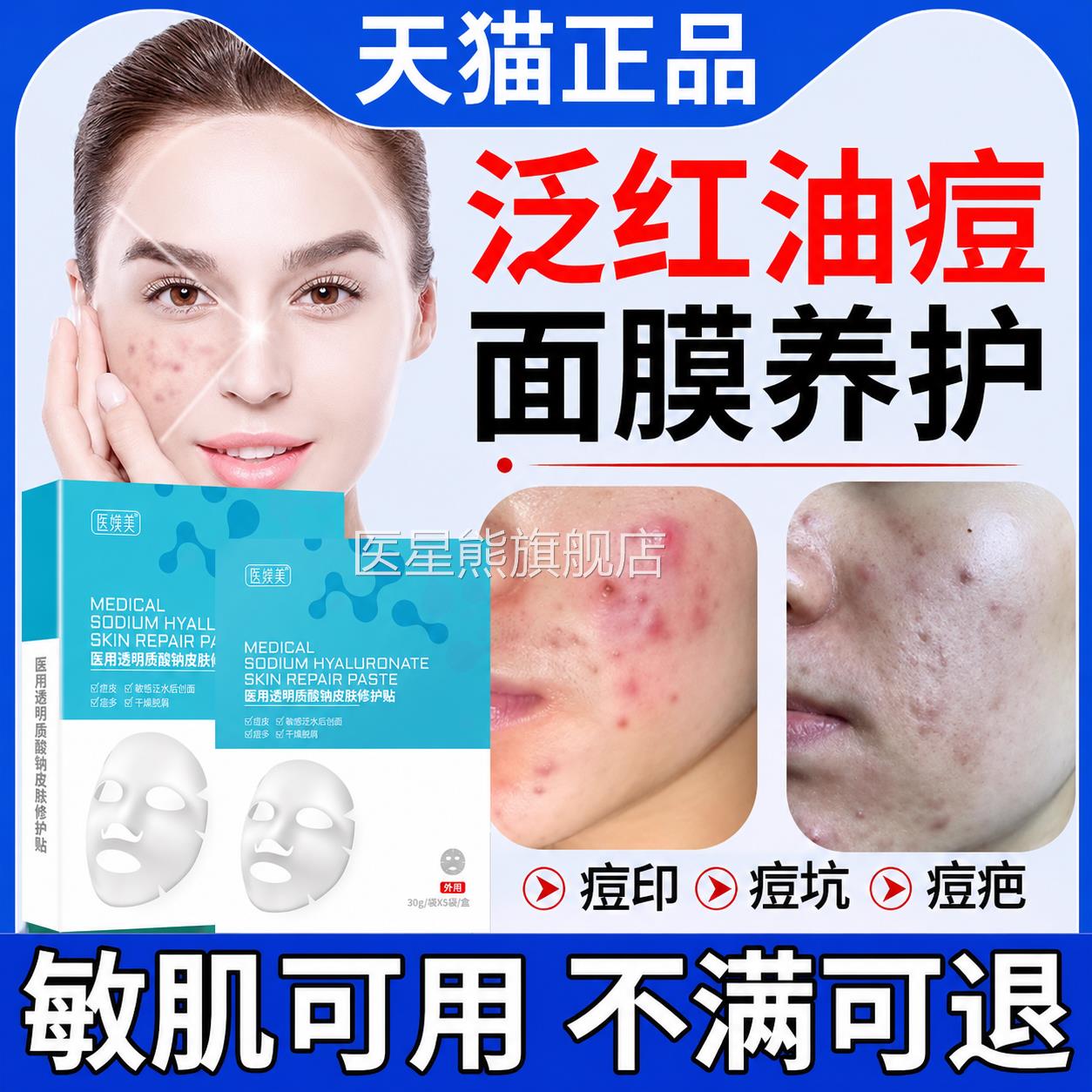面部泛红去痘印小疙瘩面膜补水修除复屏障去痘坑脓包清洁膏SK医星
