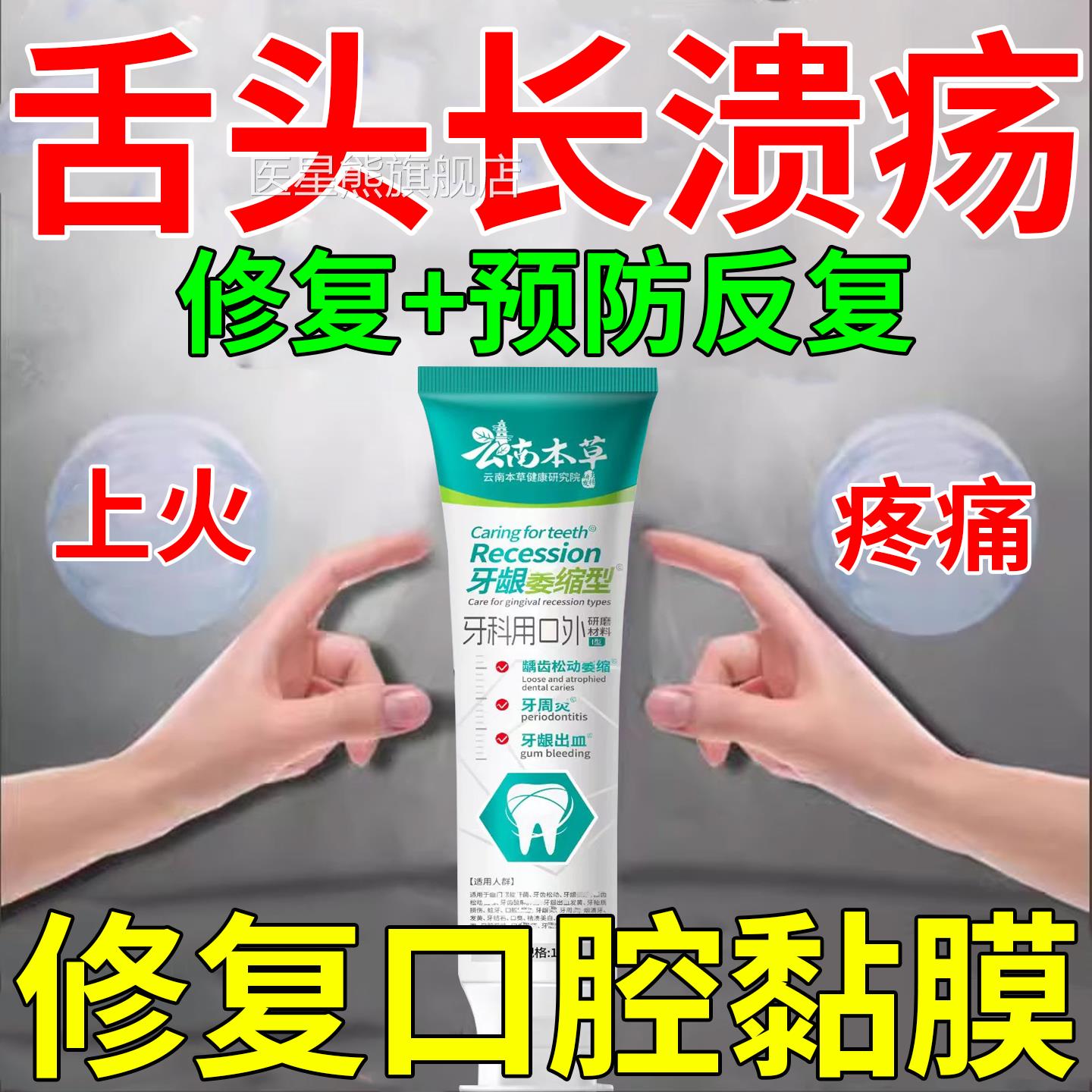 口腔溃疡专用牙膏口腔黏膜签修复口舌生疮口腔上火起泡棉棒一点灵
