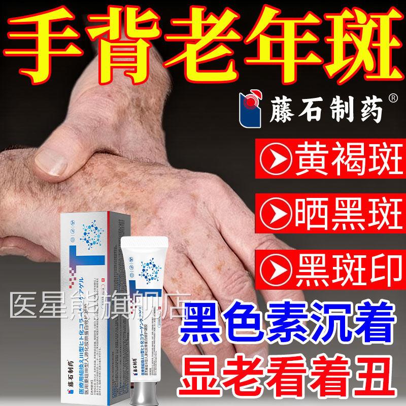 藤石制药去除老年斑店脂溢性角化斑脸部手部斑强力旗舰正品医用CA