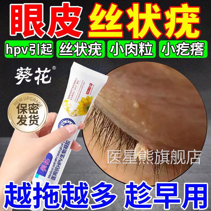 眼皮上长小肉粒丝状疣去除神器专用平膏去脸上疙瘩根脖子扁疣CA医