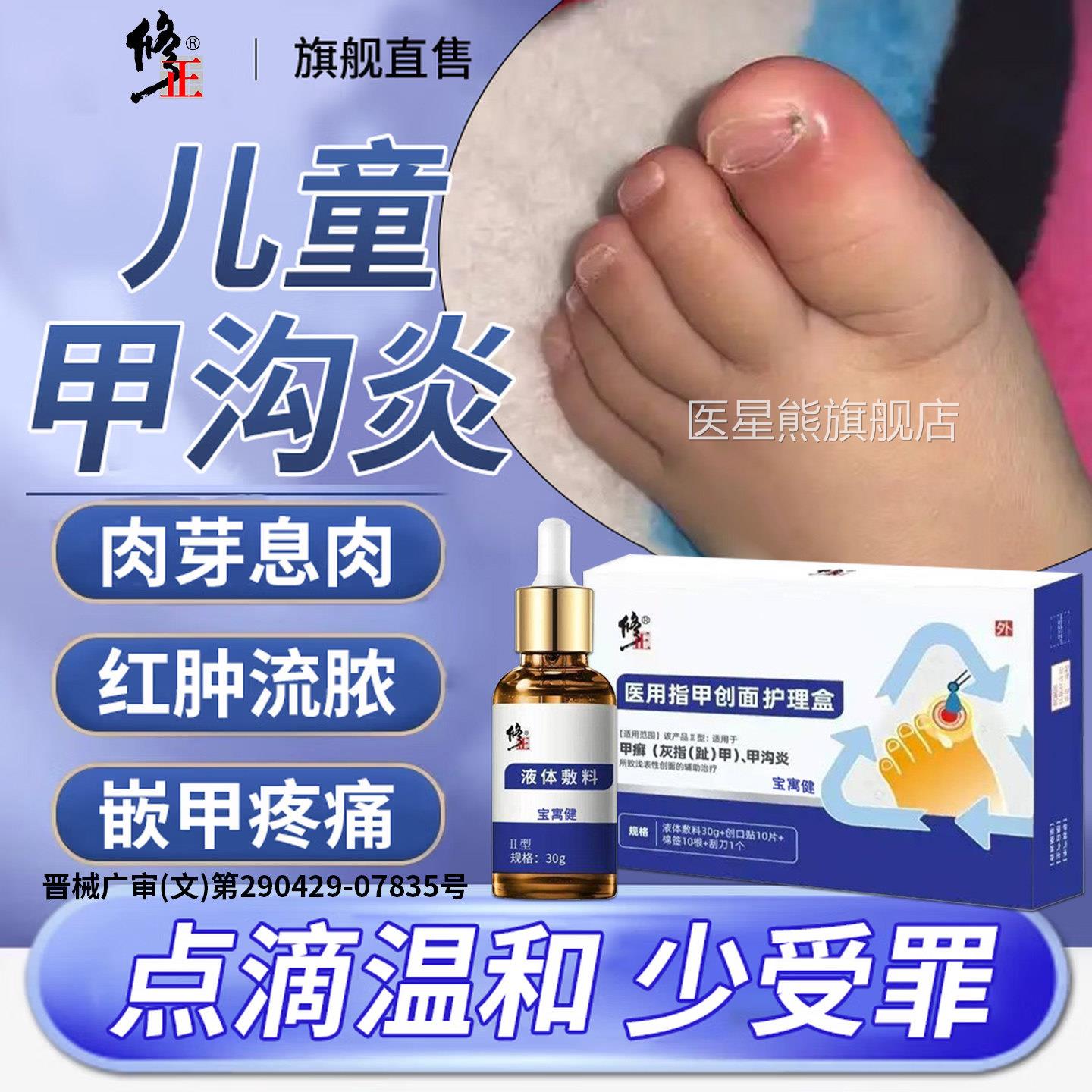 儿童甲沟炎息灰肉去除甲软化剂治指甲专用特膏神器效疗脚大拇指疼