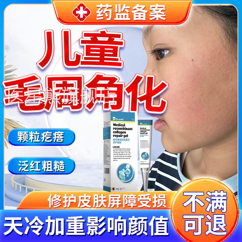 童脸儿上毛周角化毛囊去鸡皮肤霜专用脸颊两侧小疙瘩药房同售膏CA