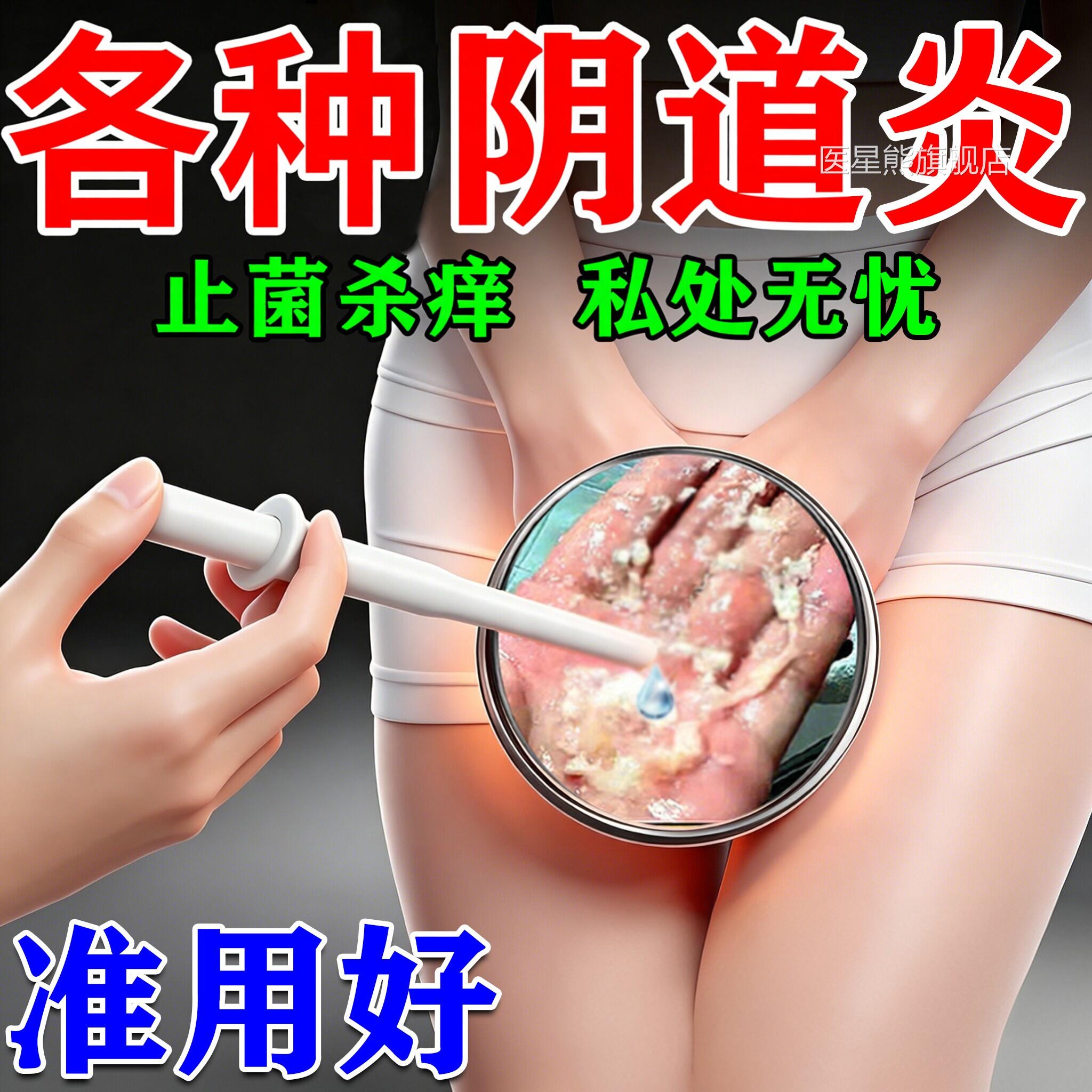 复方苦参洗液霉菌性阴道炎妇科药用膏抑菌止凝痒胶医级外阴瘙痒医