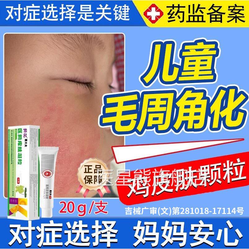 葵花毛周角化症儿童小颗粒去除Z专用鸡皮肤脸上毛囊角化药房同售Y