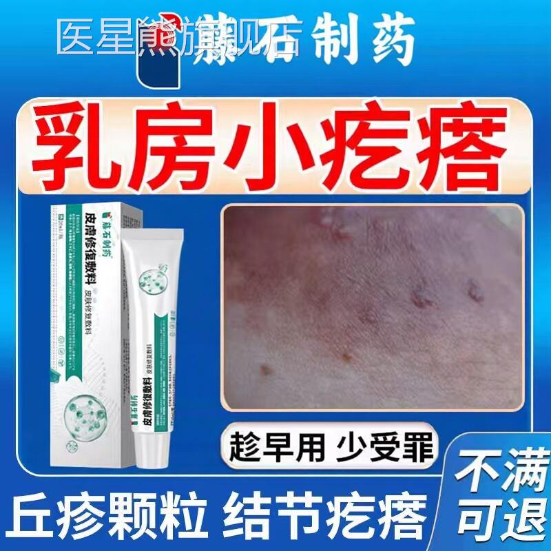 乳房蒙氏结节小疙瘩乳晕丘疹发边膏去除乳腺增生缘凸起药房同售CA