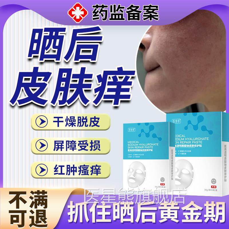 晒后修复面膜皮肤痒日光性皮炎紫外线过敏太阳晒伤痒干燥起皮S瘙A