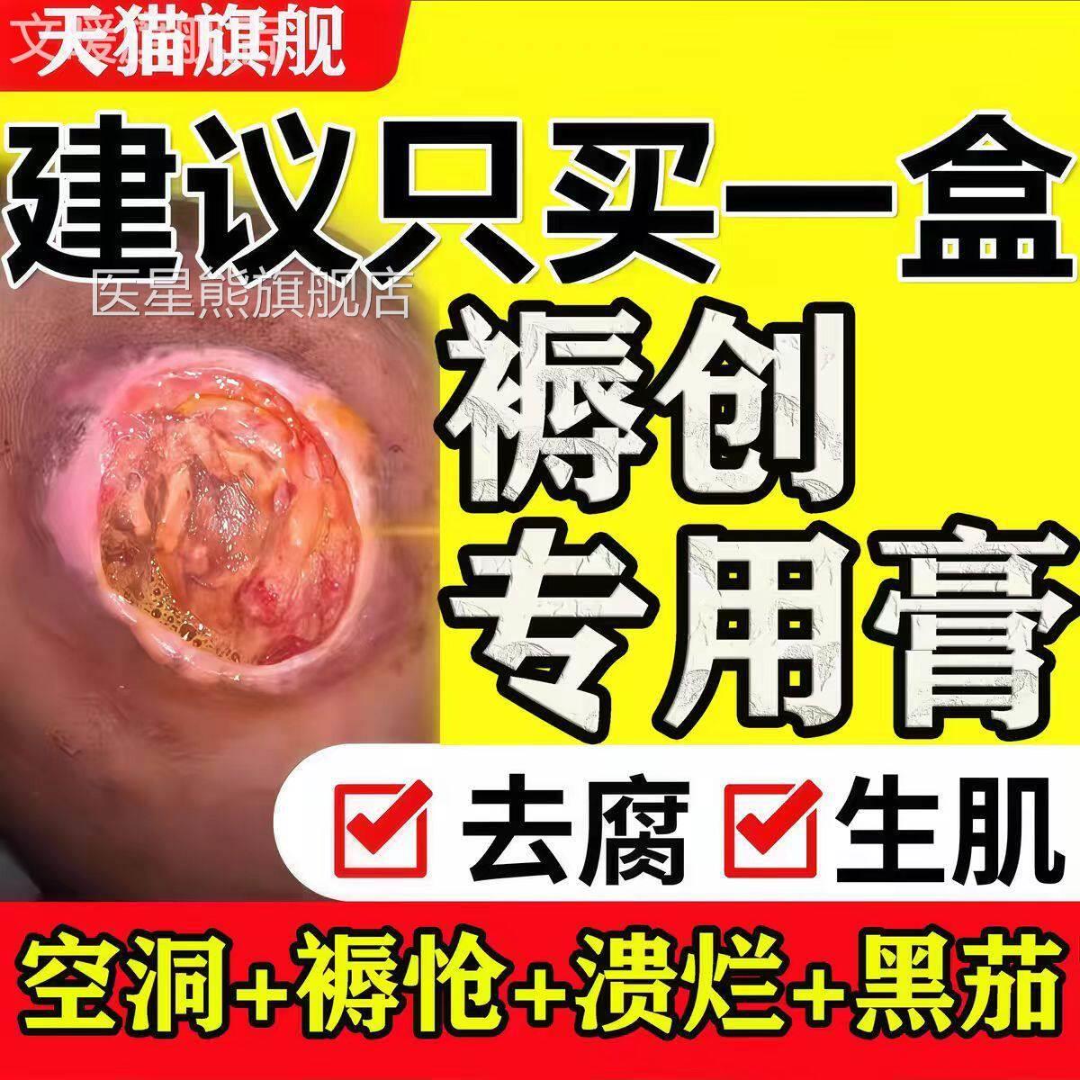 日本褥疮膏伤口促进长肉防压疮卧床瘫痪老人用臀部外用专特药膏效