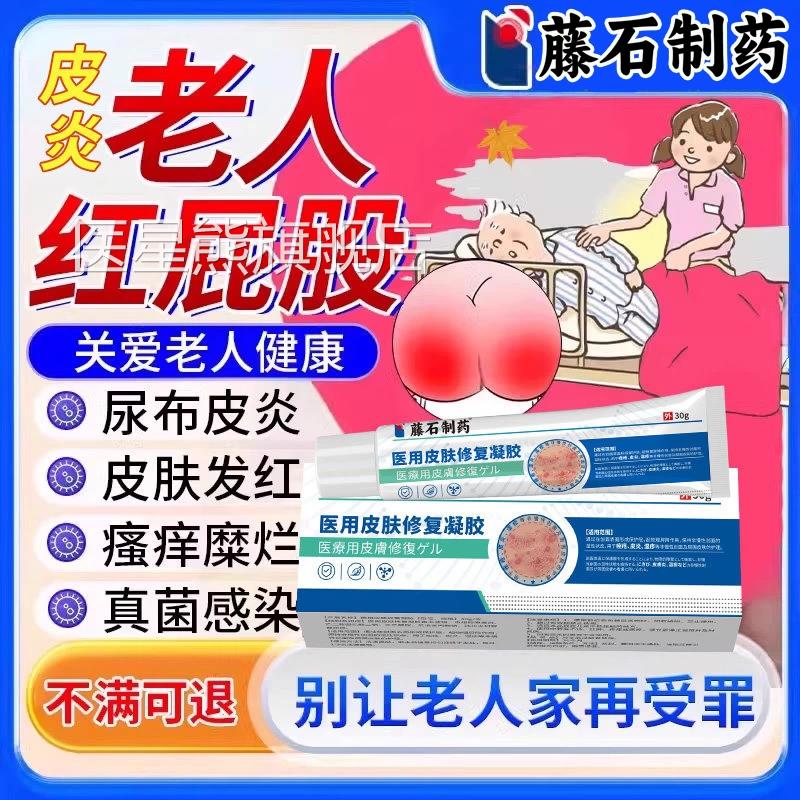 卧床老人红屁股药房同售膏尿痛布疹皮炎泛红破皮疼瘙痒护臀膏TZ医