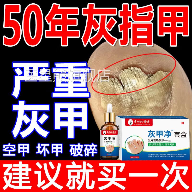 李珍灰甲净官时方旗舰店无痛去灰指甲脚趾指甲增厚甲沟焱抑菌正品