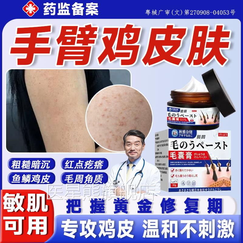 手鸡皮肤毛囊角化症药膏毛囊炎胳膊上长疙臂瘩去除脖颈儿童毛周gx
