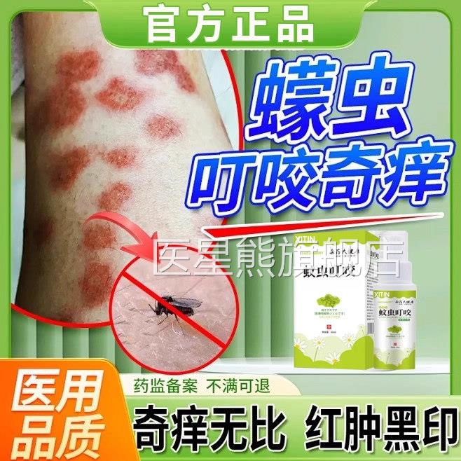 蠓虫叮咬药膏咬伤痒止消肿膏小咬克星驱蚊水防蚊虫叮咬咬伤喷剂UU