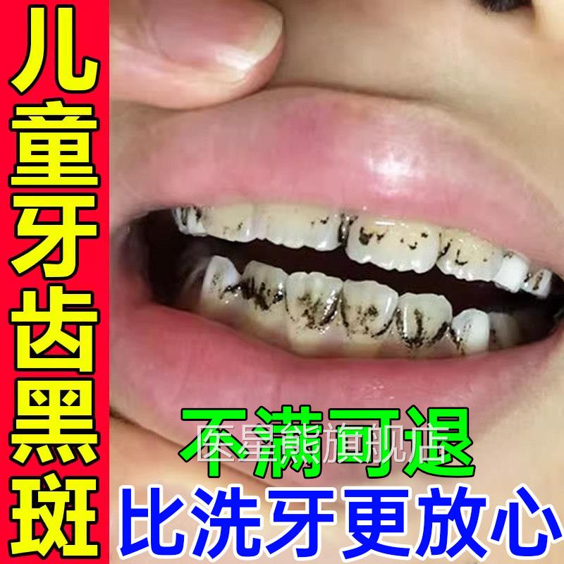 儿童黑牙齿黑色素沉淀去牙菌斑牙膏黑线 线黑斑渍污垢祛除神器美