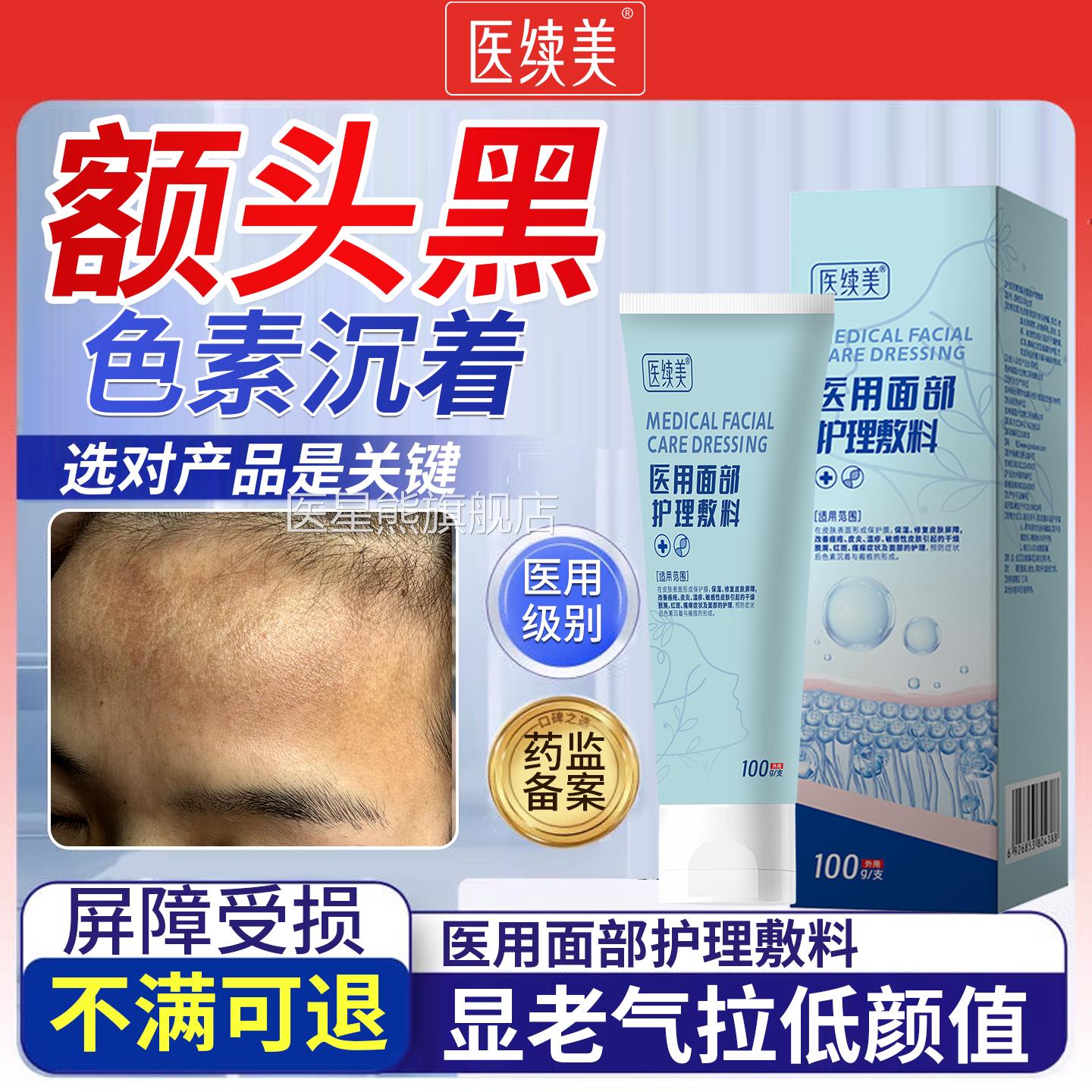 额头黑色素沉淀去黑斑去黑防额头晒黑有黑印斑洗面奶除N6医星熊旗