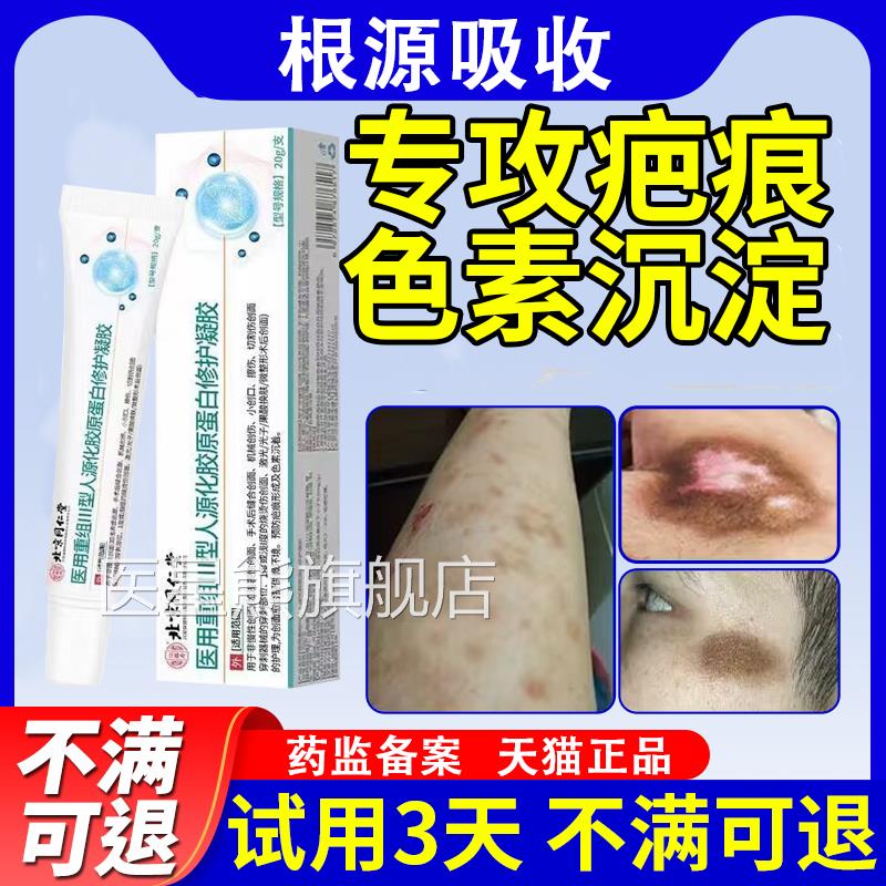 医用重组人表皮因维子生长凝胶祛除疤痕牛碱性纤成细胞祛疤凝胶医