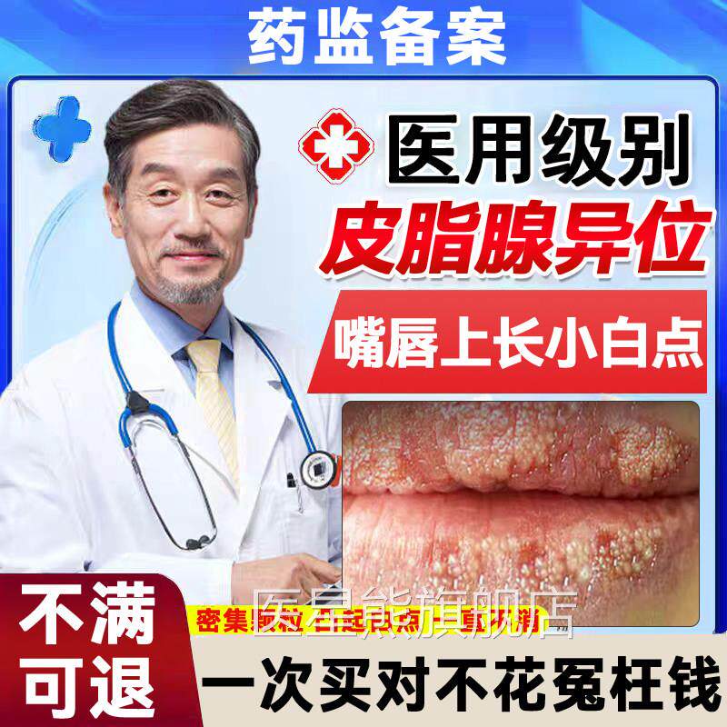 皮脂腺异位症嘴唇白点脂肪小颗白色增生粒去除干裂脱皮药膏TK医星
