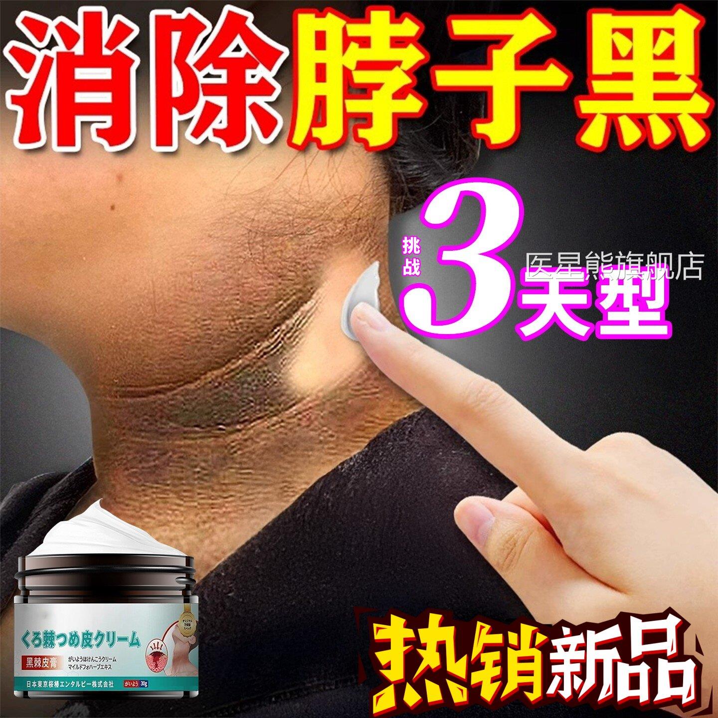 脖子黑下色素去除黑棘皮膏色素沉淀儿童脖子腋洗不干净美白神器30