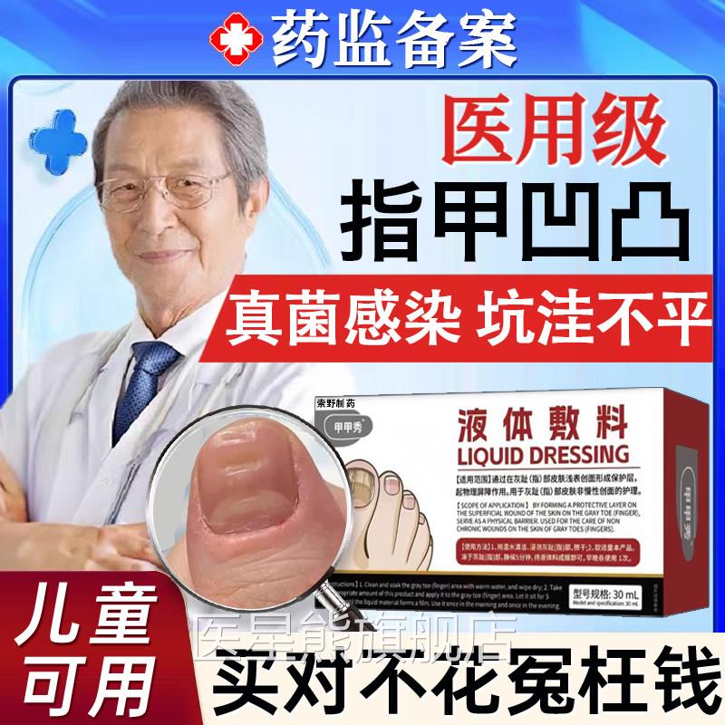 手脚指甲凹凸不T平修复液真菌感染药儿童趾甲甲床分离受损变形K医
