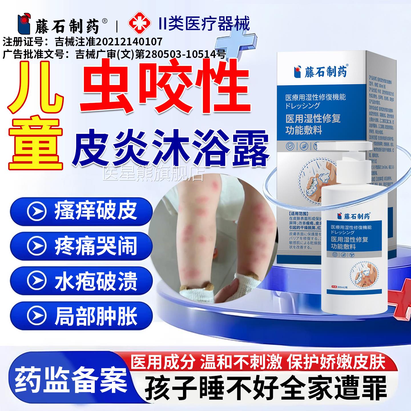 蚊虫叮皮炎湿疹专用沐浴露成人儿童止痒红肿疙瘩瘙痒药房同售P咬2