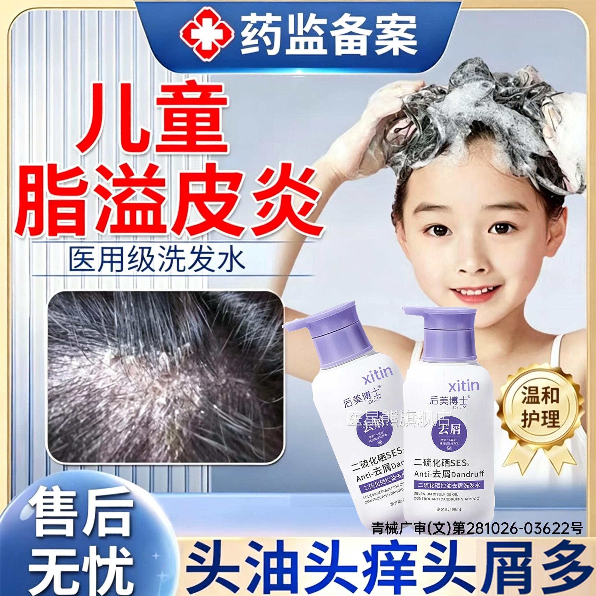 儿童二脂溢性皮炎洗发水真菌感染头癣硫化硒官方旗舰毛囊清洁止PP