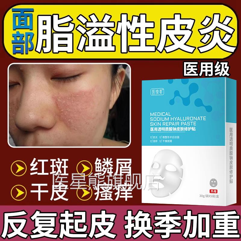 脂溢性皮炎面部专用面膜脸上季长癣干换燥起皮红斑鳞屑起皮CA医星