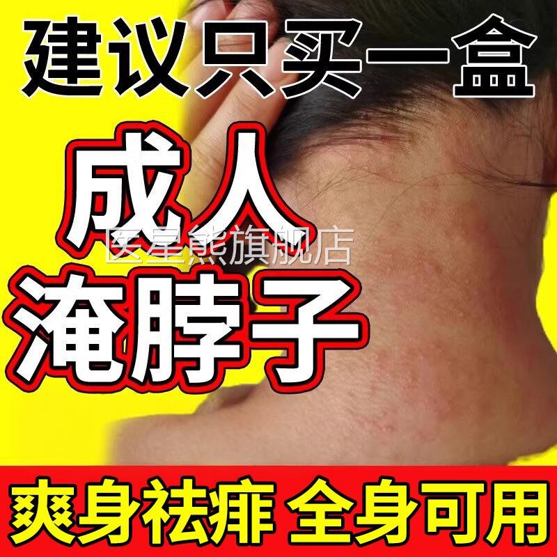 成人痱粉子防淹脖子疹非止夏季痒用吸汗湿干爽身粉女士男士医星熊
