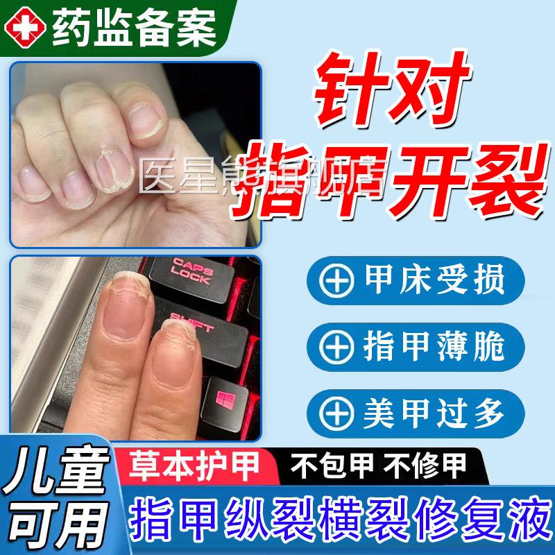 手脚指甲开 损裂修覆液中间断裂纵裂药凹凸不平薄软受再生养甲床T