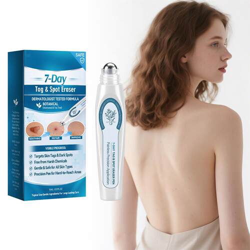 Natural skin label removal pen, painless wart eraser