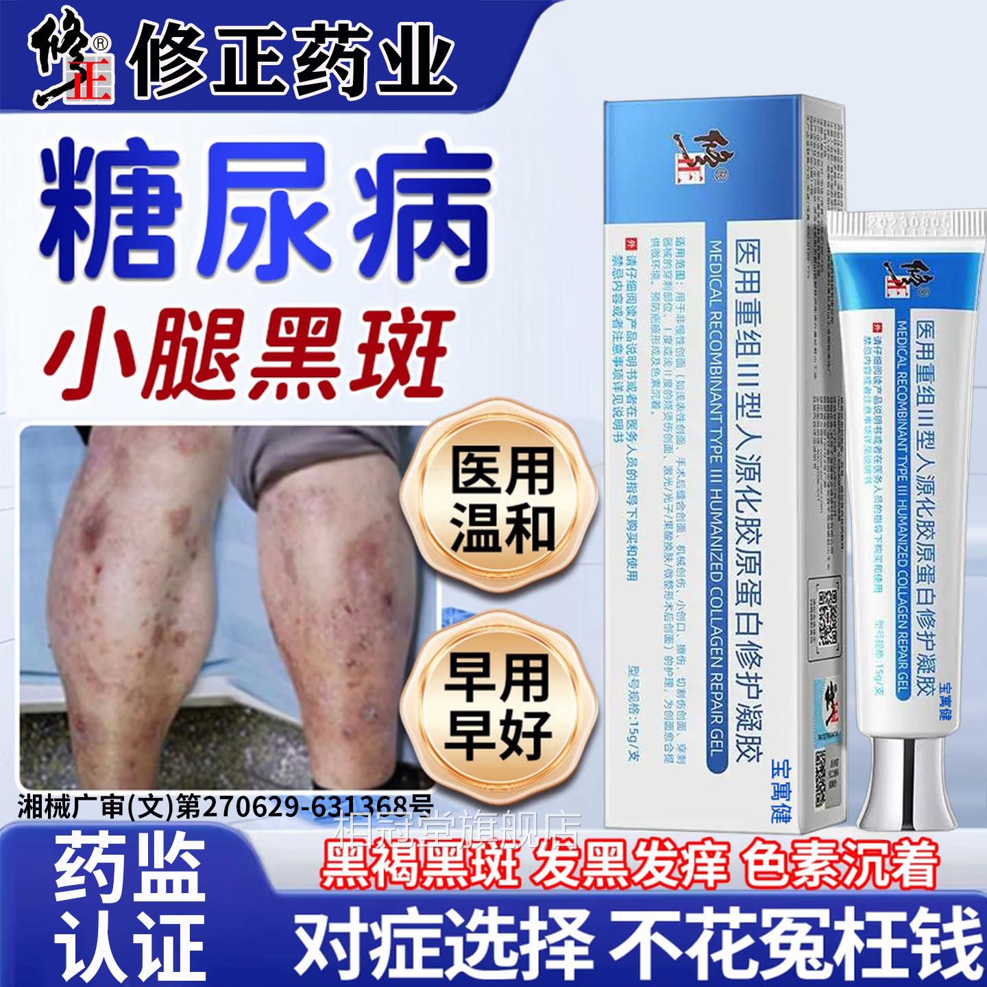 糖尿病引起小腿黑斑沉去色素淀胫前糖斑腿皮肤痒除疤痕印愈合药膏