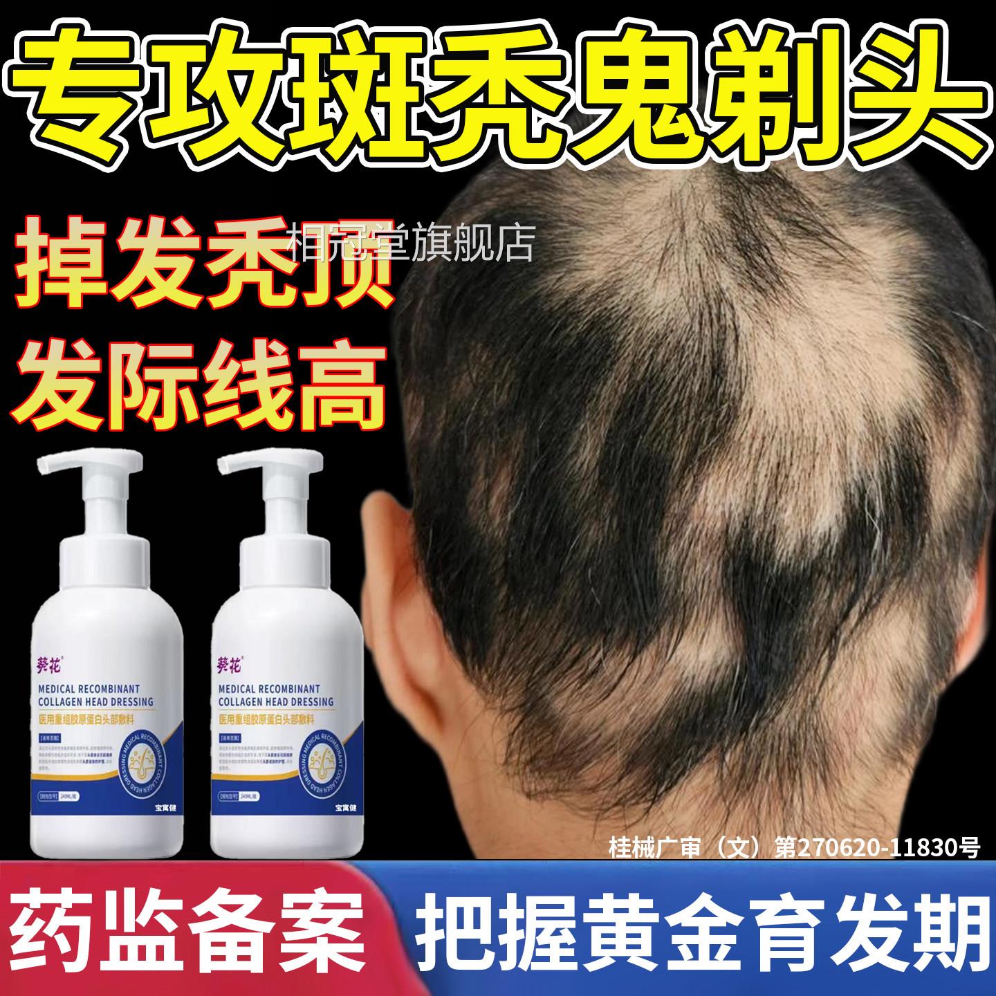 斑秃脱发效特鬼剃头药毛囊激活洗发生发液水发密发排增行榜名相冠