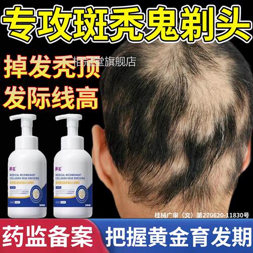 斑秃脱发效特鬼剃头药毛囊激活洗发生发液水发密发排增行榜名相冠