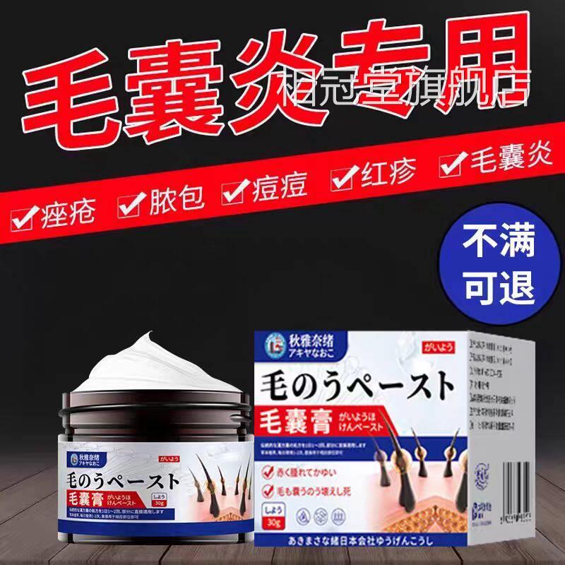 马拉色菌前胸后头背治头皮毛囊炎专用部脖子私处痘痘中药酊疗膏药