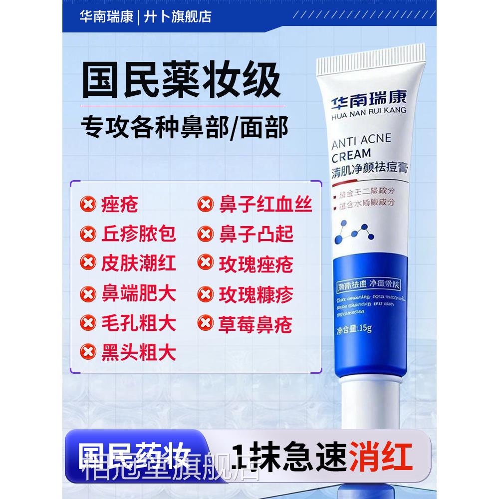 治疗红鼻子酒糟鼻药膏玫瑰痤疮翼两侧泛红药草莓鼻修复凝鼻胶消炎