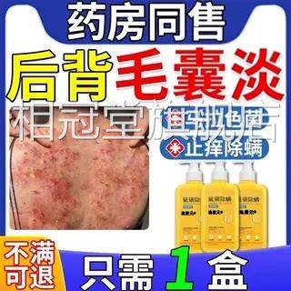 治后背长痘痘毛囊炎专用二硫化疗硒洗剂药膏马拉色菌特沐浴露效FF