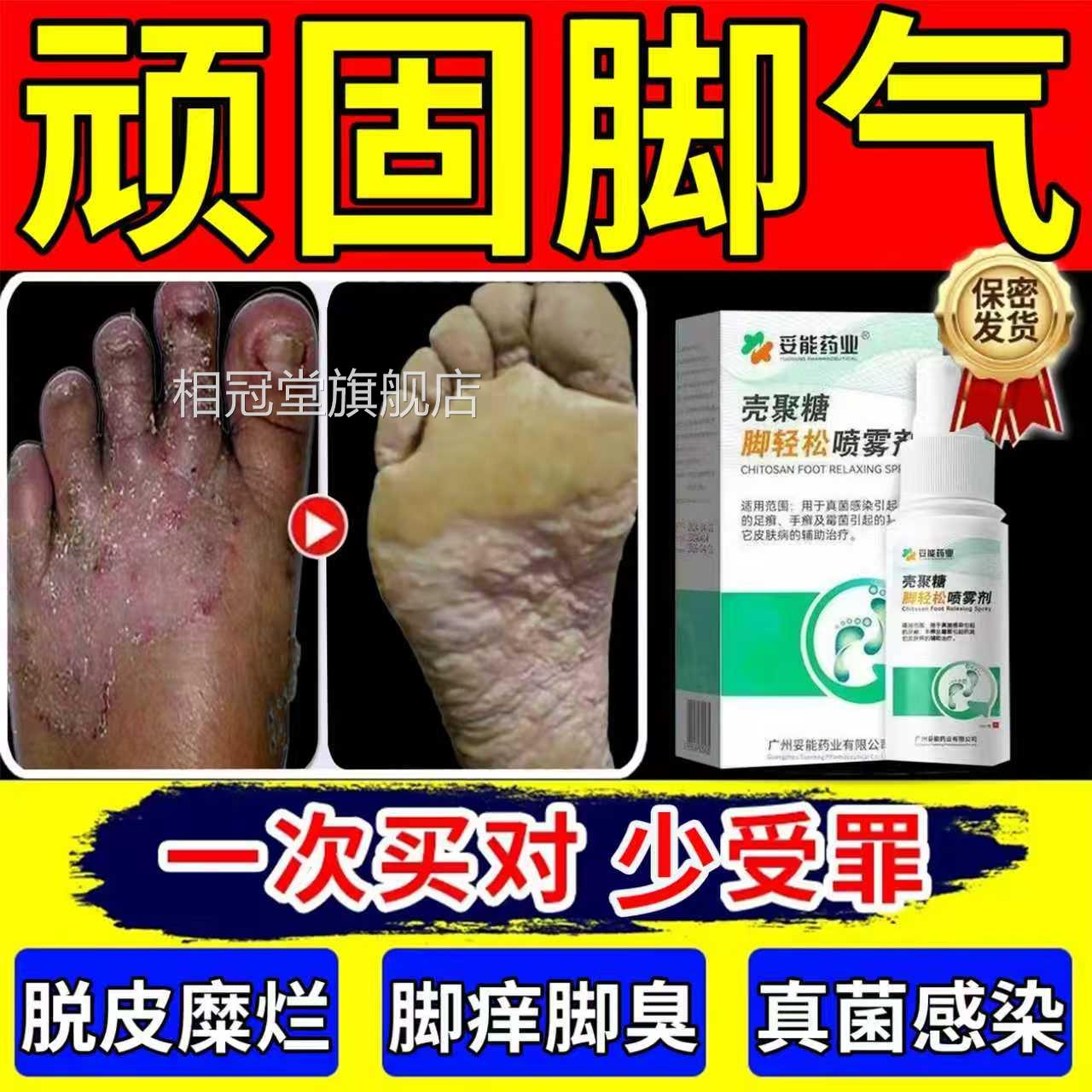 喷脚王治疗脚气脚痒止痒脱皮杀菌根去除专特效膏用狼毒官方旗舰店