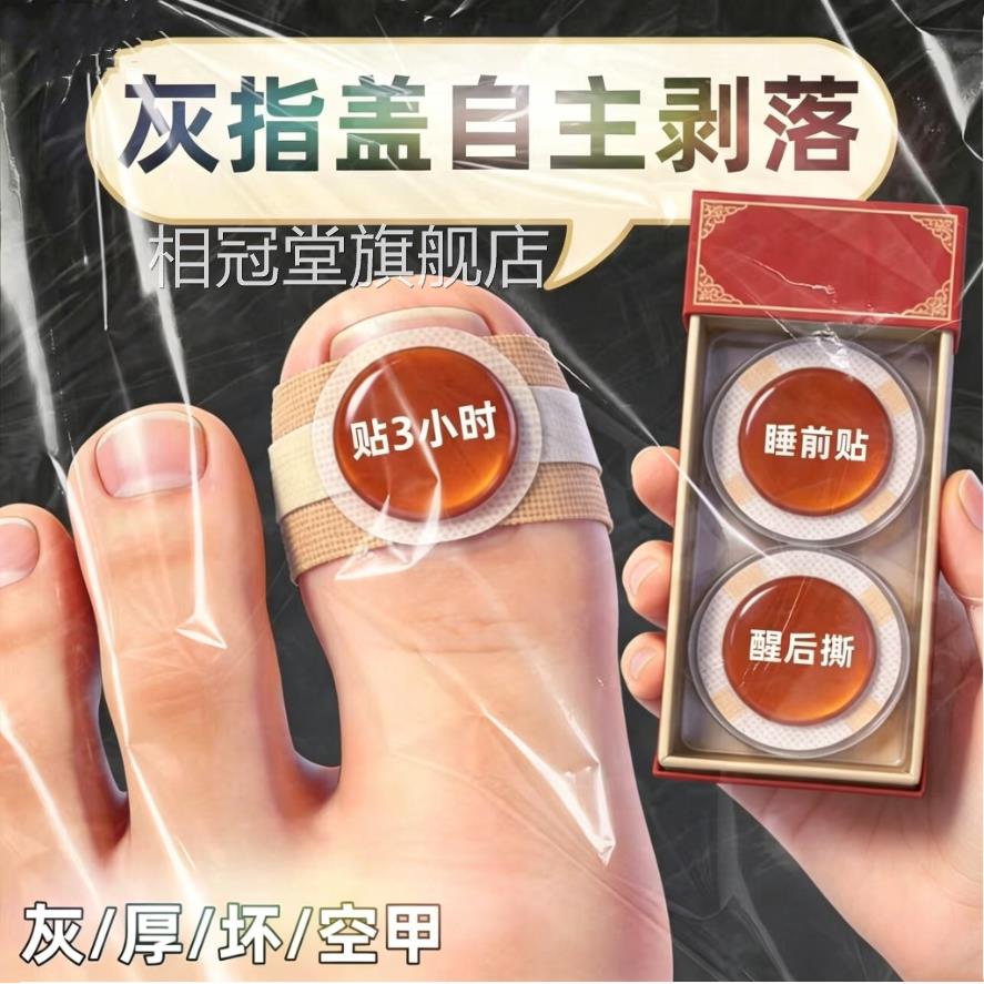 【官方正品】指甲贴正品专用灰趾贴植物萃取脚手指甲修趾护专用贴